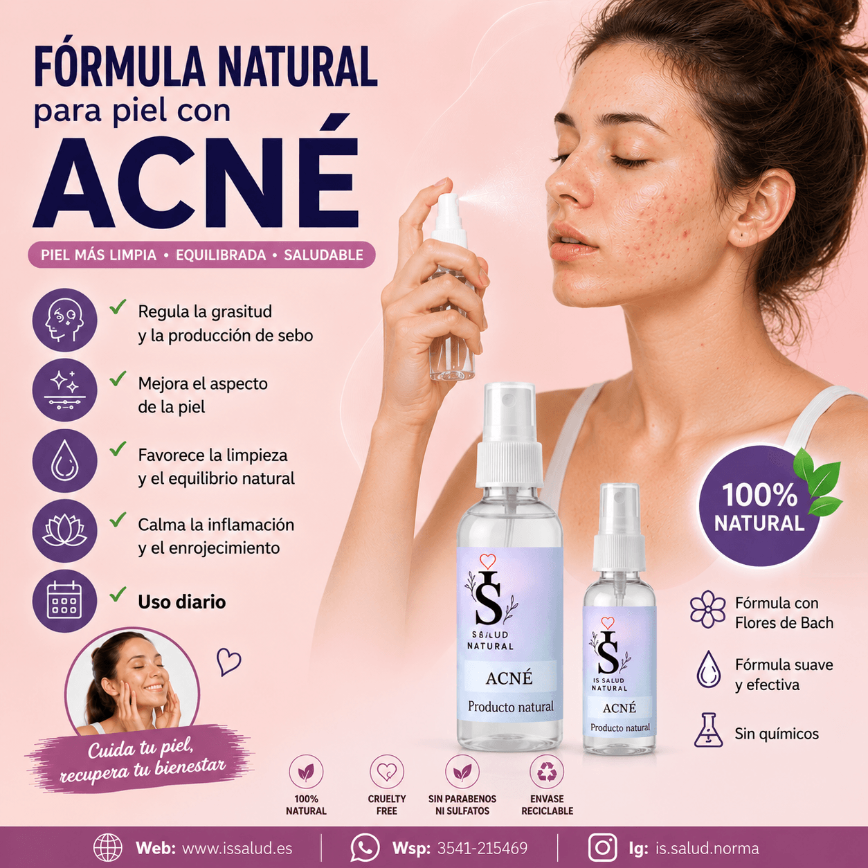 2- Acné · Spray